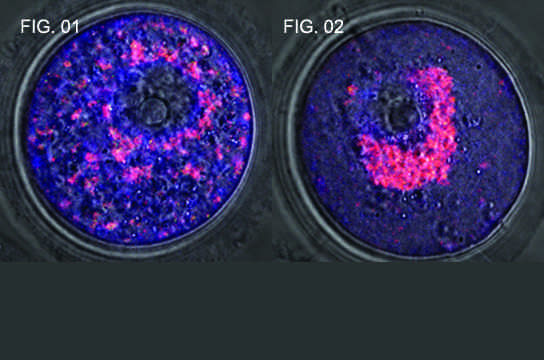 Fig 1: óvulo normal. Fig 2: óvulo que não expressa as proteínas Mfn1 e Mfn2. Foto: Pesquisa